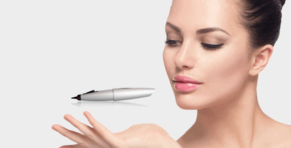 CryoPen Cryotherapy Twickenham
