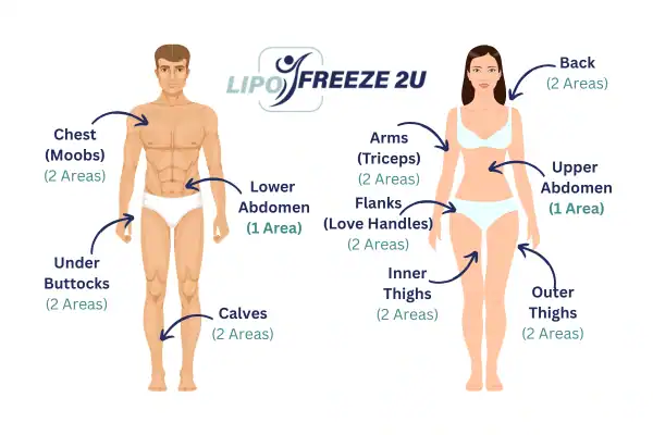 Areas you can have fat freezing treatment Twickenham