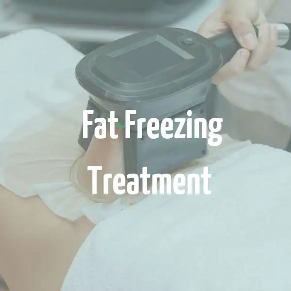 fat freezing treatment Twickenham